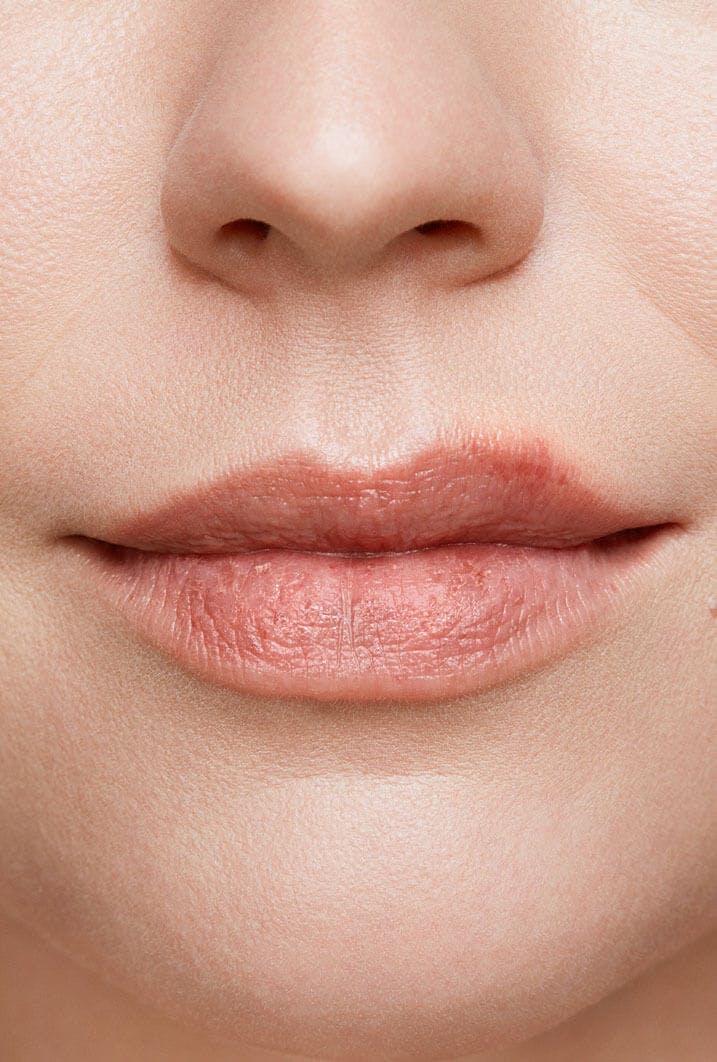 Cold sore healing stages with pictures zovirax au